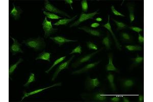 Immunofluorescence of monoclonal antibody to VCP on HeLa cell. (VCP Antikörper  (AA 221-310))