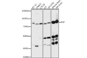 Western blot analysis of extracts of various cell lines, using NSF antibody (ABIN6130571, ABIN6144871, ABIN6144872 and ABIN6214029) at 1:3000 dilution. (NSF Antikörper  (AA 1-250))