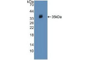 Detection of Recombinant JAK2, Human using Polyclonal Antibody to Janus Kinase 2 (JAK2) (JAK2 Antikörper  (AA 508-800))