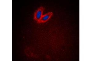 Immunofluorescent analysis of ACK1 (pY284) staining in HeLa cells. (TNK2 Antikörper  (pTyr284))