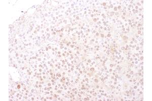Immunohistochemistry (IHC) image for anti-Minichromosome Maintenance Deficient 4 (MCM4) (AA 325-375) antibody (ABIN7449391)