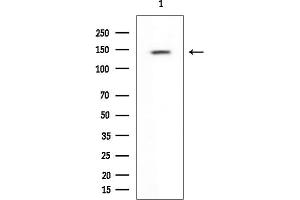Western blot analysis of lysates from Rat brain, using Bcr Mouse Monoclonal Antibody at 1/1000 dilution.