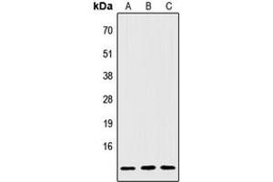 Western blot analysis of IGFL2 expression in Jurkat (A), NIH3T3 (B), H9C2 (C) whole cell lysates.