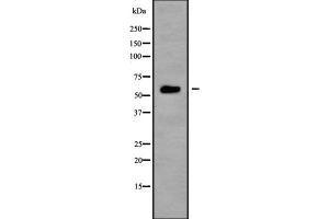 Western blot analysis NRBP1 using K562 whole cell lysates (NRBP1 Antikörper  (Internal Region))
