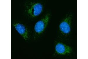 IF analysis of HEXA using anti-HEXA antibody (ABIN7599980).