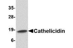 Western blot analysis of Cathelicidin in Human spleen tissue lysate with AP30207PU-N Cathelicidin antibody at 1 μg/ml. (Cathelicidin Antikörper  (C-Term))