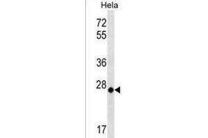 MT-CO3 Antibody (N-term) (ABIN1539412 and ABIN2838144) western blot analysis in Hela cell line lysates (35 μg/lane). (COX3 Antikörper  (N-Term))