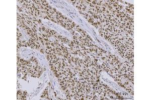 IHC analysis of PC4/SUB1 using anti-PC4/SUB1 antibody (ABIN7602185). (SUB1 Antikörper  (AA 62-127))