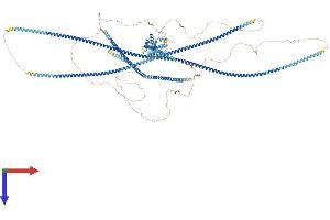 CCDC88B Protein (AA 1-1476) (His tag)