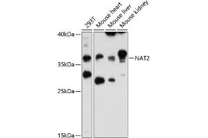 Western blot analysis of extracts of various cell lines, using N antibody (ABIN6132387, ABIN6144378, ABIN6144379 and ABIN6216511) at 1:3000 dilution. (NAT2 Antikörper  (AA 171-290))