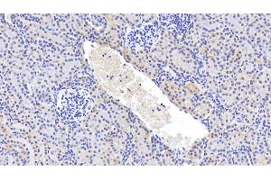 Detection of GPC4 in Human Kidney Tissue using Polyclonal Antibody to Glypican 4 (GPC4) (GPC4 Antikörper  (AA 261-527))