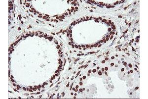 Immunohistochemical staining of paraffin-embedded Human breast tissue using anti-FBXO21 mouse monoclonal antibody. (FBXO21 Antikörper)