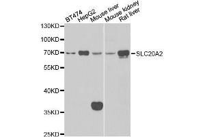 Western blot analysis of extracts of various cell lines, using SLC20A2 antibody. (SLC20A2 Antikörper  (AA 235-485))
