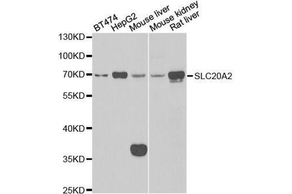 SLC20A2 抗体  (AA 235-485)