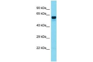 Host:  Rabbit  Target Name:  FOXO6  Sample Type:  Colorectal Tumor lysates  Antibody Dilution:  1. (Foxo6 Antikörper  (Middle Region))
