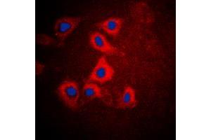 Immunofluorescent analysis of HEXB staining in HepG2 cells. (HEXB Antikörper  (C-Term))