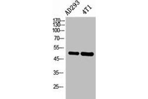 Western Blot analysis of AD293, 4T1 cells using IL-6Rα Polyclonal Antibody. (IL-6 Receptor Antikörper  (Internal Region))