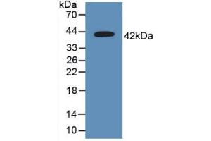 Western blot analysis of recombinant Human TSPAN30. (CD63 Antikörper  (AA 103-203))