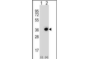 Western blot analysis of DHRS3 (arrow) using rabbit polyclonal DHRS3 Antibody (Center) (ABIN653135 and ABIN2842711). (DHRS3 Antikörper  (AA 85-113))