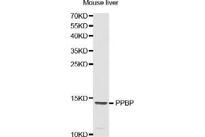 Western Blotting (WB) image for anti-Pro-Platelet Basic Protein (Chemokine (C-X-C Motif) Ligand 7) (PPBP) (AA 31-128) antibody (ABIN1513400) (CXCL7 Antikörper  (AA 31-128))