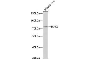 Western blot analysis of extracts of mouse liver, using IR antibody (ABIN3016606, ABIN3016607, ABIN3016608 and ABIN6219797) at 1:1000 dilution. (IRAK2 Antikörper  (AA 1-270))