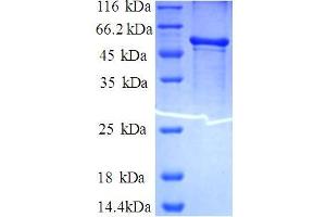 SDS-PAGE (SDS) image for LIM Domain Only 1 (Rhombotin 1) (LMO1) (AA 2-183) protein (GST tag) (ABIN5712203)