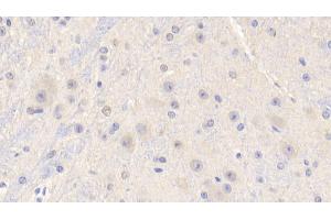 Detection of IGF1 in Mouse Cerebrum Tissue using Polyclonal Antibody to Insulin Like Growth Factor 1 (IGF1) (IGF1 Antikörper  (AA 33-102))