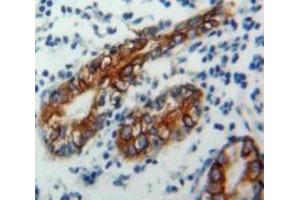 Used in DAB staining on fromalin fixed paraffin-embedded Stomach tissue (CD1d Antikörper  (AA 64-298))