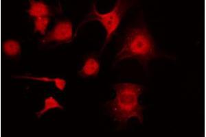 ABIN6274185 staining COLO205 by IF/ICC. (KAPC A/B Antikörper)