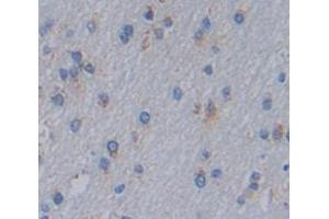 IHC-P analysis of Kidney tissue, with DAB staining. (IL1RAPL1 Antikörper  (AA 113-276))