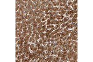 Immunohistochemical staining of human liver with ZNF160 polyclonal antibody  shows strong cytoplasmic positivity in hepatocytes. (ZNF160 Antikörper)