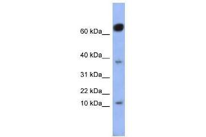 NKX6-3 antibody used at 0. (NK6 Homeobox 3 Antikörper  (Middle Region))