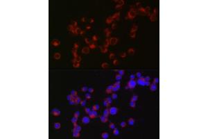 Immunofluorescence analysis of Neuro-2a cells using DCX Rabbit pAb (ABIN3021509, ABIN3021510, ABIN3021511 and ABIN6215166) at dilution of 1:50 (40x lens). (Doublecortin Antikörper  (AA 11-360))