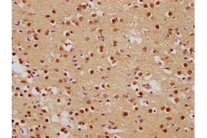 IHC image of ABIN7139839 diluted at 1:500 and staining in paraffin-embedded human brain tissue performed on a Leica BondTM system. (Foxo6 Antikörper  (AA 211-218))