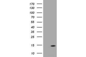 Image no. 3 for anti-D-Dopachrome Tautomerase (DDT) antibody (ABIN1497800)