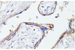 Immunohistochemistry of paraffin-embedded Human placenta using LTF Polyclonal Antibody at dilution of 1:100 (40x lens). (Lactoferrin Antikörper)