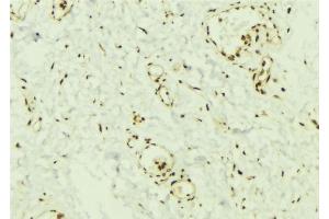 ABIN6269368 at 1/100 staining Mouse muscle tissue by IHC-P. (SMAD2 Antikörper  (C-Term))