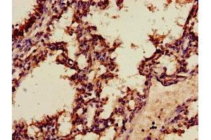 Immunohistochemistry of paraffin-embedded human lung tissue using ABIN7144268 at dilution of 1:100 (Annexin A2 Antikörper  (AA 2-339))