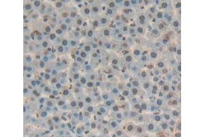 Used in DAB staining on fromalin fixed paraffin- embedded liver tissue (DKC1 Antikörper  (AA 298-509))