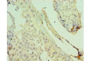 Immunohistochemistry of paraffin-embedded human testis tissue using ABIN7158699 at dilution of 1:100 (KDM4B Antikörper  (AA 1-260))