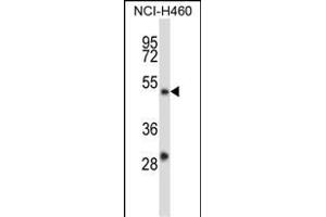 YY2 Antibody (C-term) (ABIN657589 and ABIN2846590) western blot analysis in NCI- cell line lysates (35 μg/lane). (YY2 Antikörper  (C-Term))