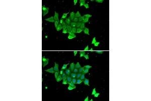 Immunofluorescence (IF) image for anti-phosphohistidine Phosphatase 1 (PHPT1) (AA 1-125) antibody (ABIN6215139) (PHPT1 Antikörper  (AA 1-125))