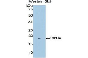 Western Blotting (WB) image for anti-Periostin (POSTN) (AA 500-630) antibody (ABIN1860279) (Periostin Antikörper  (AA 500-630))