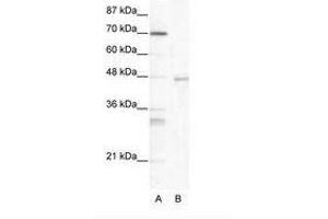 Image no. 1 for anti-Heat Shock Transcription Factor 4 (HSF4) (AA 172-221) antibody (ABIN203154) (HSF4 Antikörper  (AA 172-221))