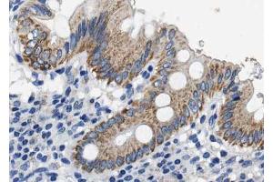 ABIN6268714 at 1/100 staining human colon tissue sections by IHC-P. (CXCL12 Antikörper  (C-Term))