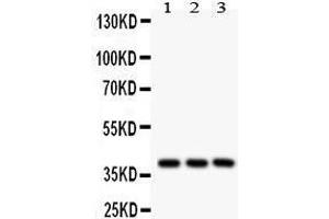 Western Blotting (WB) image for anti-Prostaglandin E Receptor 2 (Subtype EP2), 53kDa (PTGER2) (AA 281-308), (C-Term) antibody (ABIN3043363) (PTGER2 Antikörper  (C-Term))