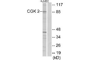 Western blot analysis of extracts from HUVEC cells, using CGK 2 antibody. (PRKG2 Antikörper)