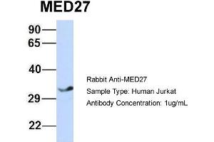 Host: Rabbit Target Name: MED27 Sample Type: Jurkat Antibody Dilution: 1. (MED27 Antikörper  (Middle Region))