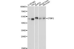 Western blot analysis of extracts of various cell lines, using CTBP2 Antibody (ABIN5971262) at 1:3000 dilution. (CTBP2 Antikörper)