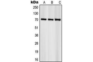 Western blot analysis of S6K1 (pS418) expression in NIH3T3 (A), HeLa (B), KNRK (C) whole cell lysates. (RPS6KB1 Antikörper  (C-Term, pSer418))